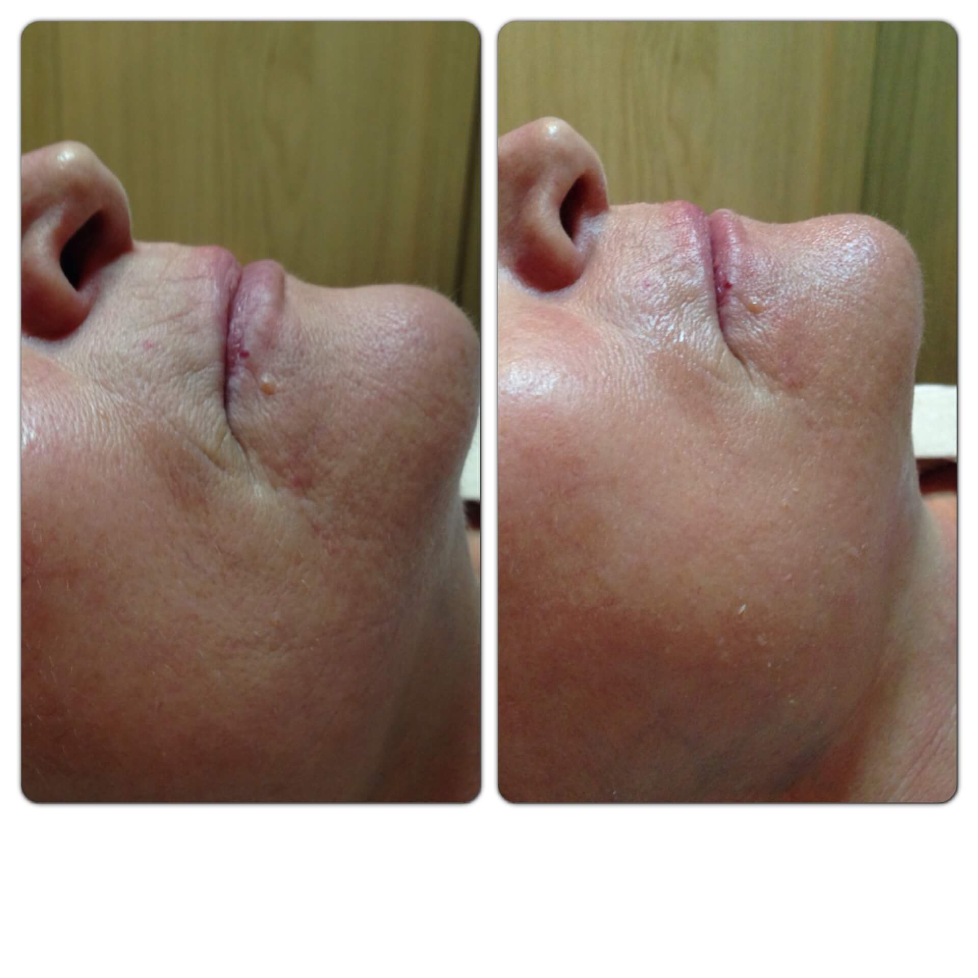 NBE DEEP SKIN